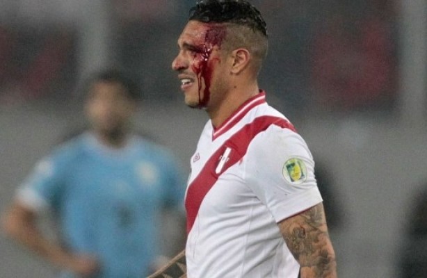 Guerrero foi parar no hospital depois de partida pela seleo peruana na sexta