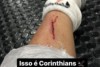Adson mostra corte na perna aps entrada de Thiago Heleno: Isso  Corinthians