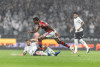 Dupla titular deixa campo lesionada contra o Flamengo e preocupa o Corinthians