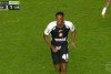 Volante do Corinthians sai de campo com rosto ensanguentado no clássico; veja a imagem