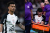 Corinthians confirma les&otilde;es de Hugo Farias e Kaio C&eacute;sar na vit&oacute;ria sobre o Capivariano