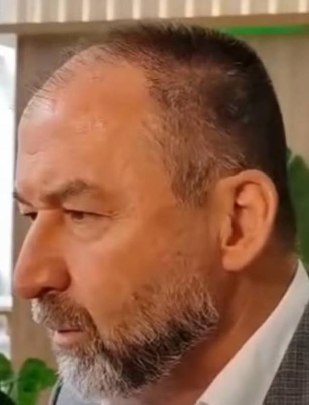 Os cambistas levaram o cabelo do Augusto Melo