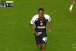 Volante do Corinthians sai de campo com rosto ensanguentado no cl�ssico; veja a imagem